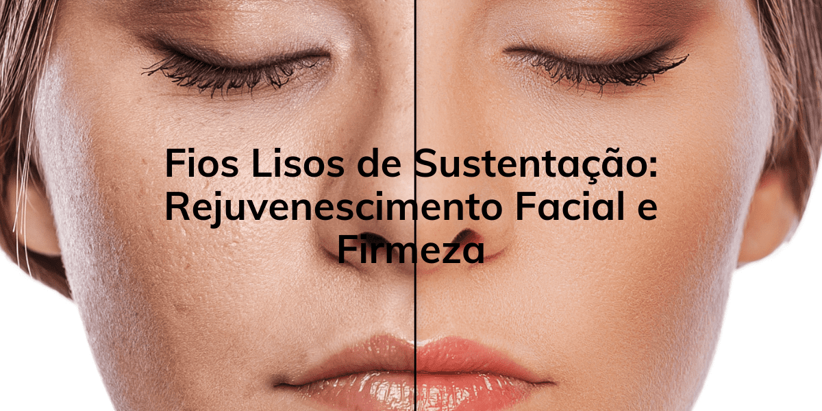 Fios Lisos de Sustentação Rejuvenescimento Facial e Firmeza Clinica