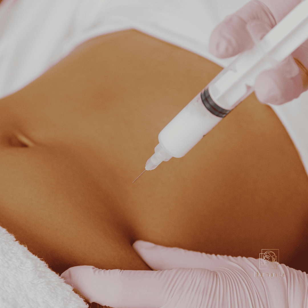 aplicação Lipo Enzimatica