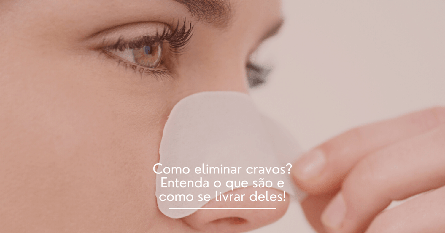 Como eliminar cravos? Entenda o que são e como se livrar deles!