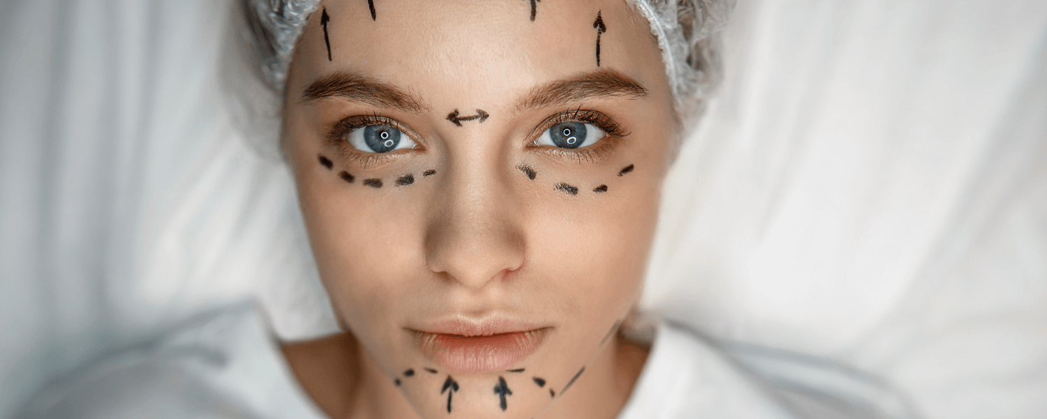 Quais procedimentos podem ser feitos na harmonização facial?