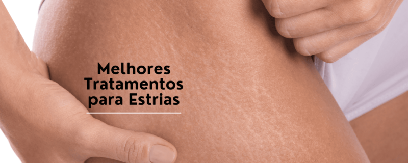 Descubra os melhores tratamentos para estrias e como eles podem ajudar a melhorar a aparência da sua pele. Conheça opções como o tratamento a laser, microagulhamento, peeling químico, radiofrequência e ácido retinoico. Na Clínica de Estética e Harmonização Facial, oferecemos uma equ