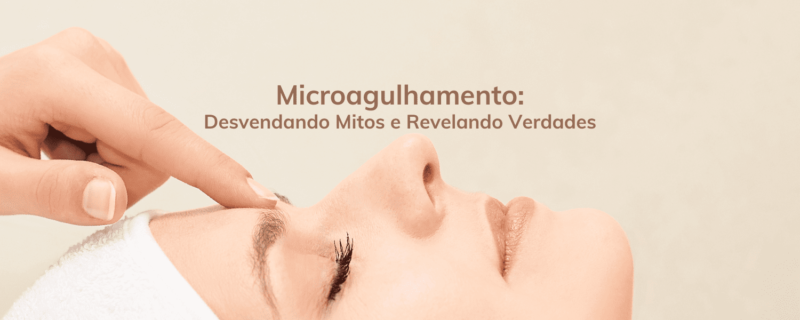 Descubra os mitos e verdades sobre o microagulhamento e como esse tratamento pode trazer benefícios para a sua pele. Saiba o que esperar, a importância de um profissional qualificado e a segurança do procedimento. Tenha uma pele radiante com o microagulhamento!"