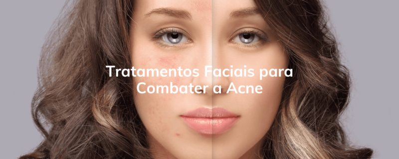 Descubra os tratamentos faciais mais eficazes para combater a acne e espinhas, restaurando a saúde e a beleza da sua pele. Agende uma avaliação na Clínica Humanitá Estética e confie em profissionais qualificados para obter resultados visíveis e duradouros.