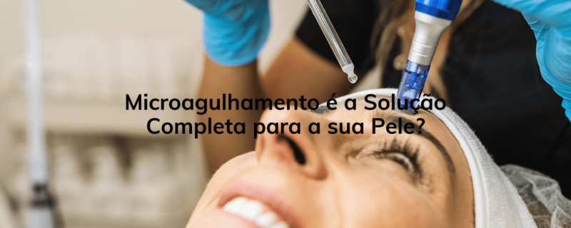 Você está cansado de gastar dinheiro com produtos para a pele que prometem resultados milagrosos, mas nunca cumprem o que prometem? Se a resposta for sim, então você precisa conhecer o microagulhamento.