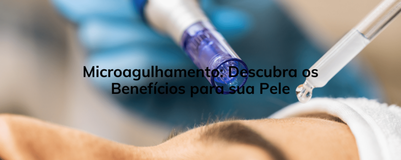 "Microagulhamento: Descubra os Benefícios para sua Pele e Agende sua Avaliação!"