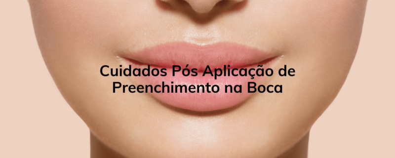 Descubra os cuidados essenciais após a aplicação de preenchimento na boca para manter um sorriso perfeito. Conheça as dicas para garantir