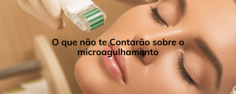 Descubra o que não te contam sobre o microagulhamento. Este guia revela verdades essenciais, cuidados necessários e desmistifica mitos para garantir uma experiência segura e eficaz.