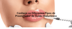 Conheça os Diferentes Tipos de Preenchedor de Ácido Hialurônico