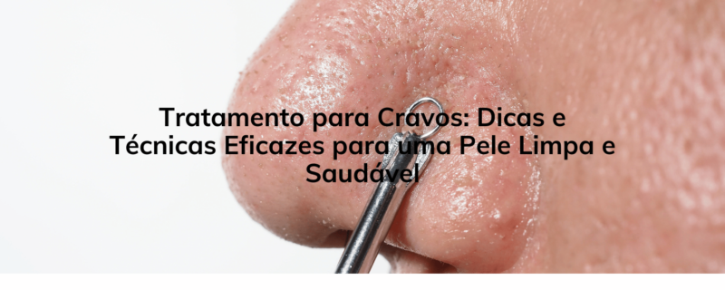 Tratamento para Cravos: Dicas e Técnicas Eficazes para uma Pele Limpa e Saudável