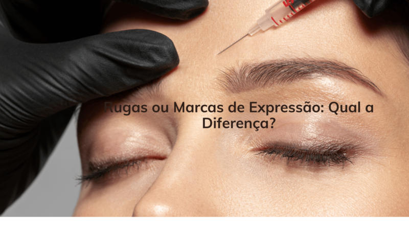 Rugas ou Marcas de Expressão: Qual a Diferença?