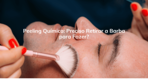 Peeling Químico: Preciso Retirar a Barba para Fazer?