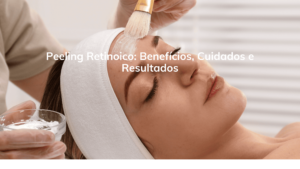 Peeling Retinoico: Benefícios, Cuidados e Resultados